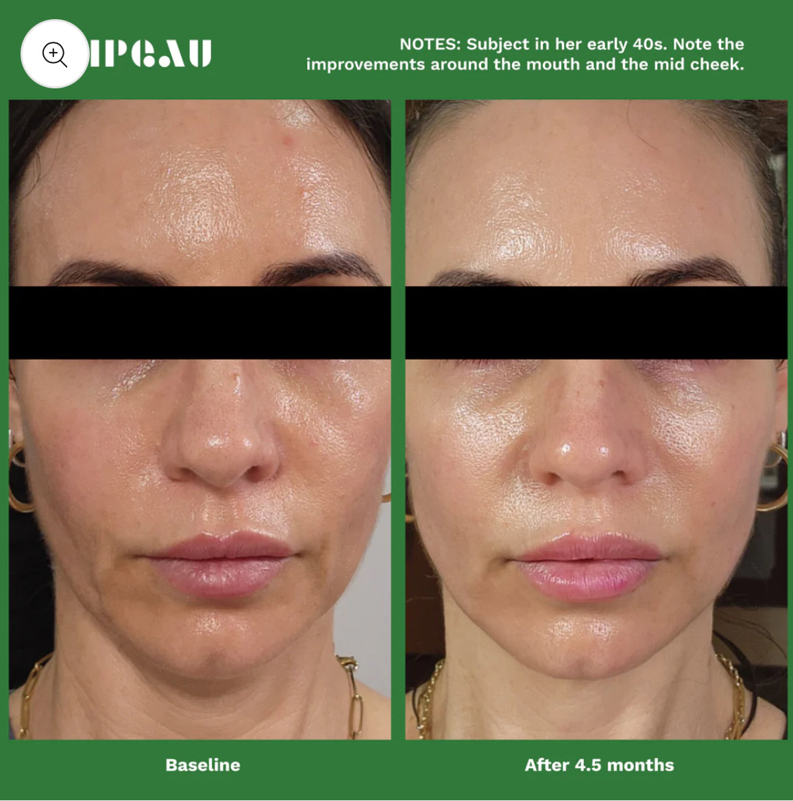 Adipeau Volume Cream